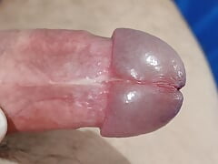 Young man prepares his dick for transplant surgery.